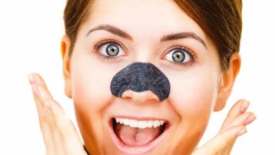blackheads–causes-&-treatment