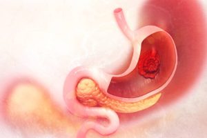 Human stomach