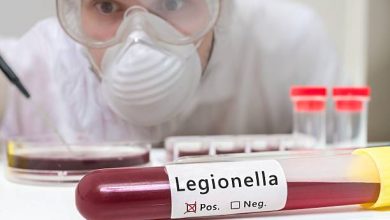 How Often Does Water Need to Be Tested for Legionella