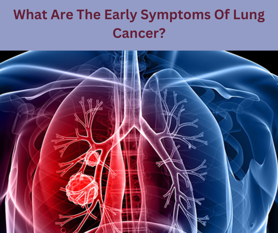 Lung Cancer