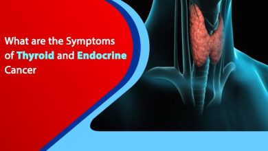 Endocrine Surgery