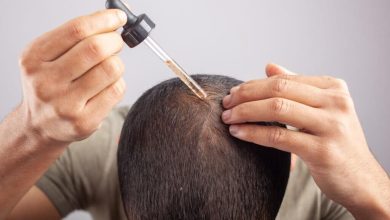 MINOXIDIL 5%